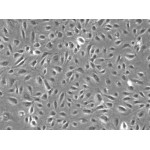 Human Brain Microvascular Endothelial Cells (HBMVEC)